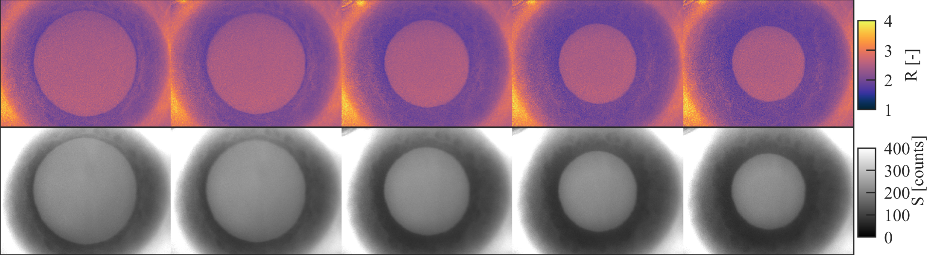 Fluorescence images of a healthy human eye